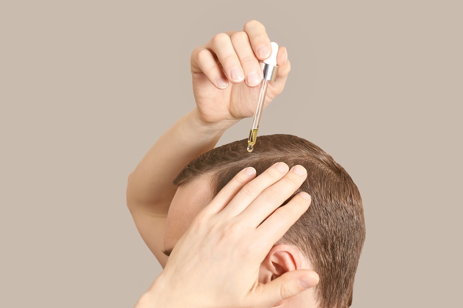 How often to apply minoxidil to your scalp