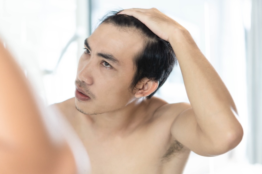 Man considering increasing minoxidil frequency