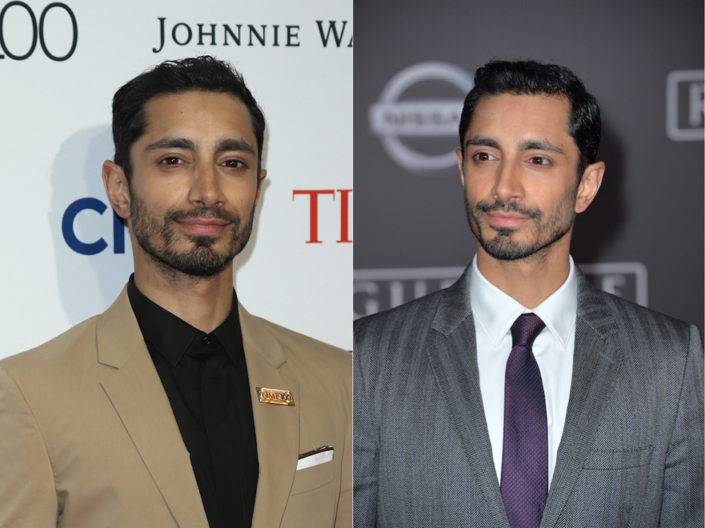 Riz Ahmed has stage 2 male pattern baldness