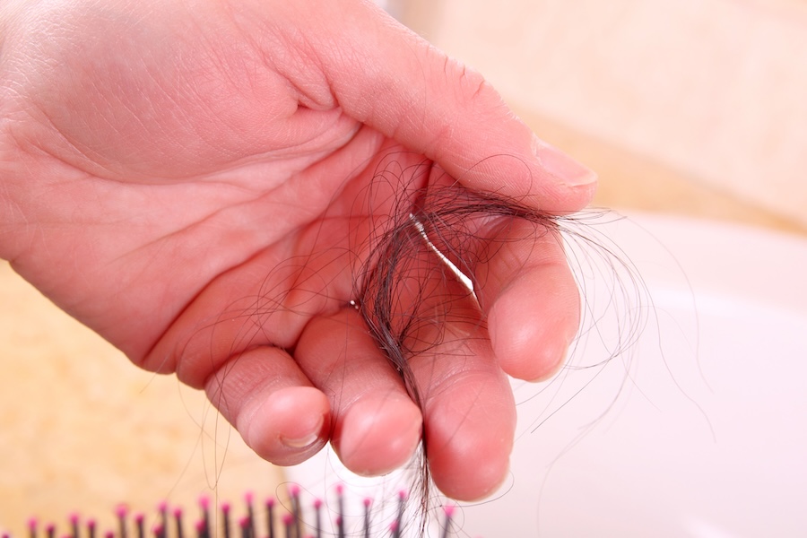 Temporary minoxidil hair shedding