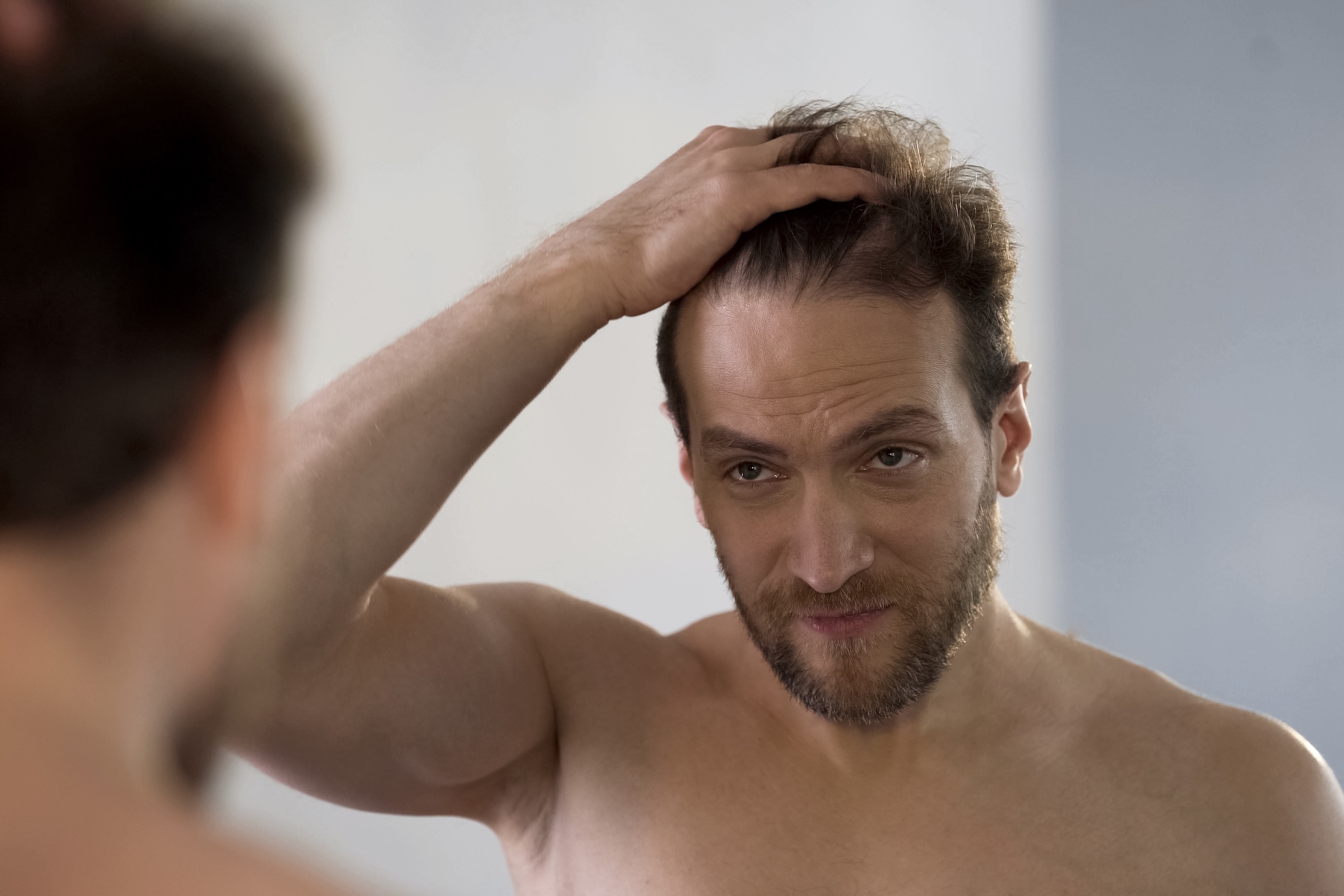 Man examining hair loss after minoxidil