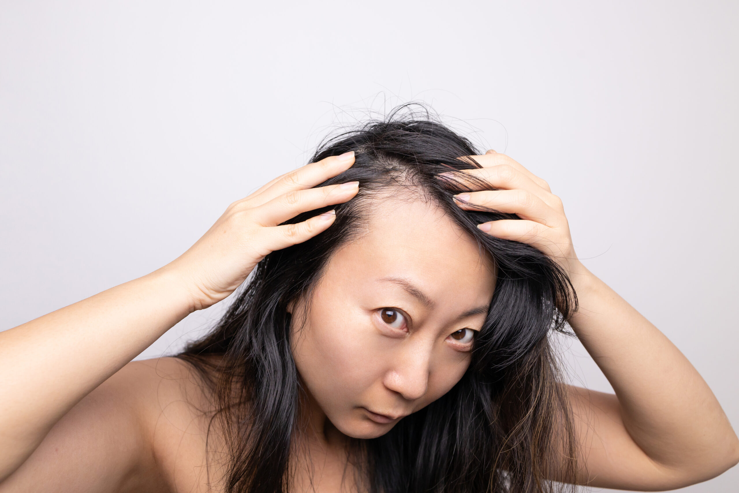 Is finasteride safe for women