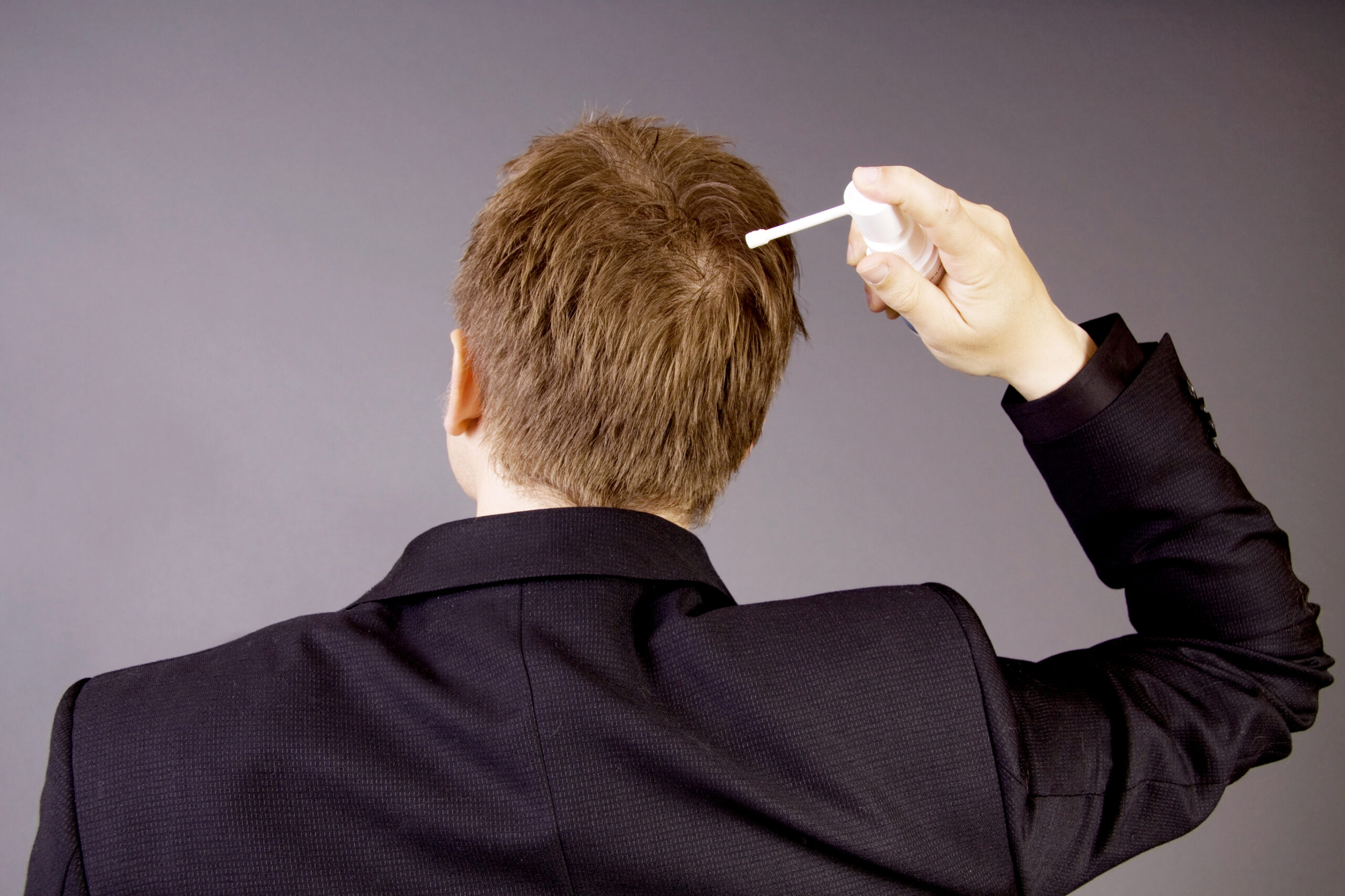 man using an alternative hair loss treatment to finasteride